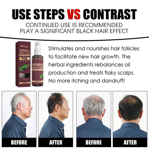Southmoon 100ml Hair Darkening Herbal Spray White To Black Natural Color Repair Anti Grey Reduce Hair Loss Herbal Haircare Serum