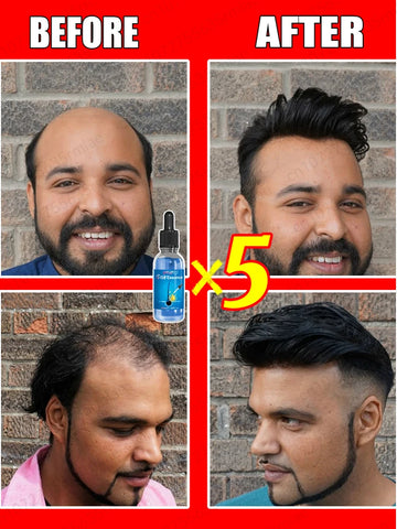 The most effective hair growth essential oil in 2024. Experts authoritatively certified,effective in repairing baldness and hair
