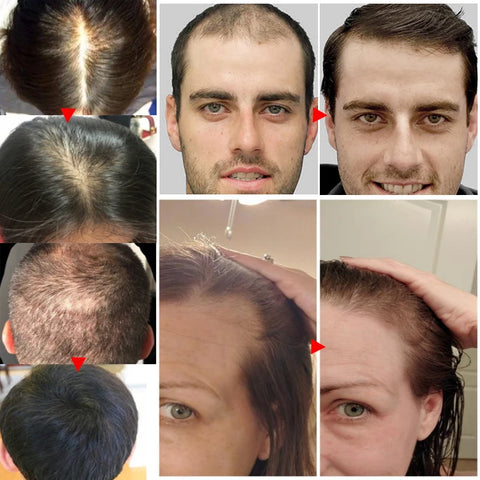 Fast Hair Growth Serum Hair Regrowth Essential Oil Anti Hair loss Repair Damaged Scalp Women Men Anti Baldness Hair Growth Care